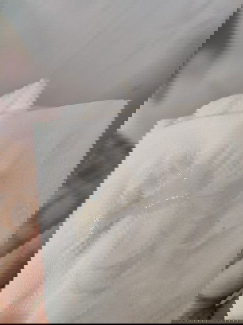 Bung nút nhầy trắng ??