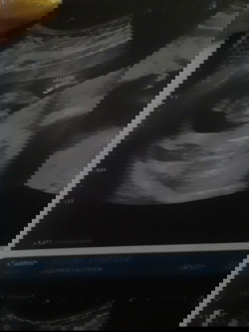 ทีมกย.65หน่อยค่ะใครได้ ลูกชายหรือลูกสาวบ้าง