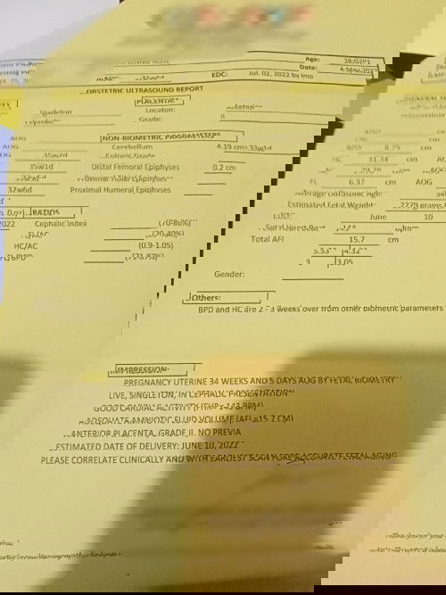 Duedate via utz or Lmp