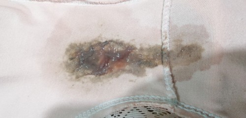 3 months preggy going to 4.
may brown discharge ngayon lang.