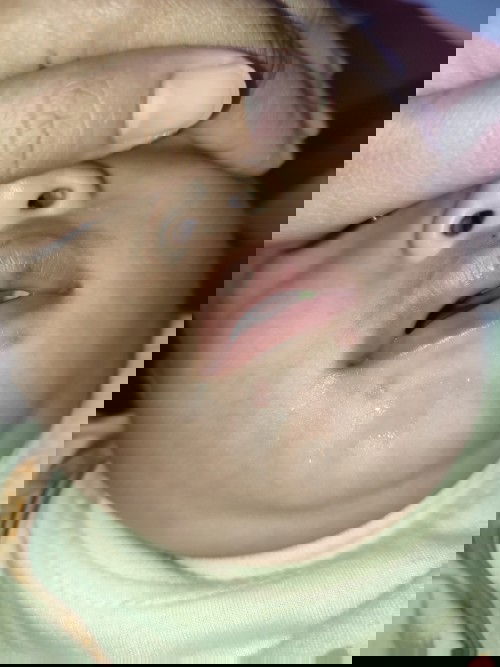 Bintik merah dibawah bibir