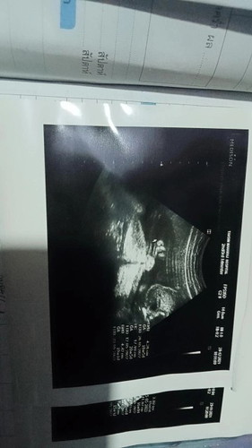 ลูกสาวรึลูกชาย