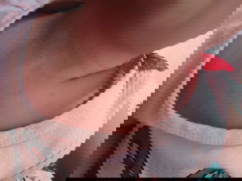 Butlig sa leeg ni baby