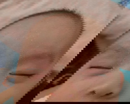 ผิวหน้าลูกแห้ง แตกเป็นขุย