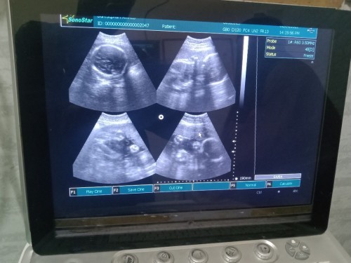 Berat badan bayi