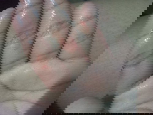 มีน้ำใสๆไหลออกจากช่องคลอด