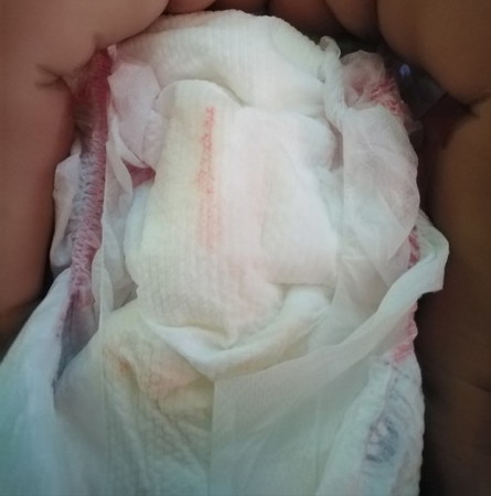 DUGO SA IHI 7 WEEKS OLD