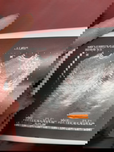 Result of Trans V