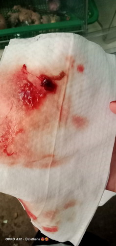 14weeks pregnancy bleeding