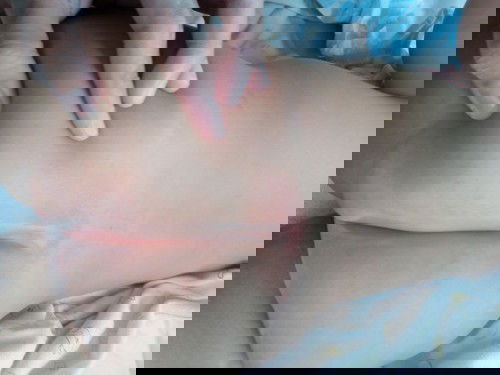 Anong gamot sa rashes?