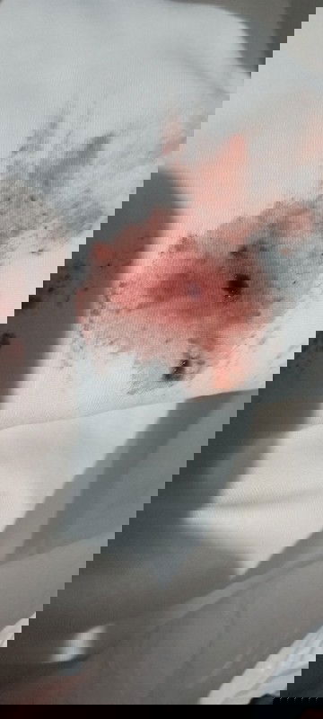 Pendarahan hamil 6 minggu