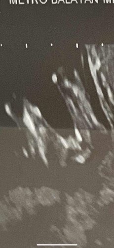 Girl or boy?