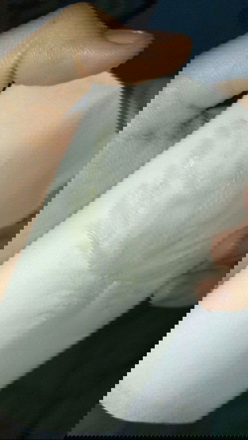 Keputihan saat hamil