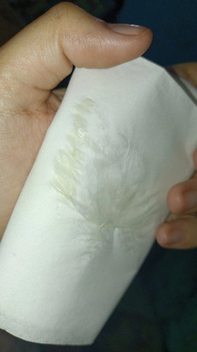 Keputihan saat hamil