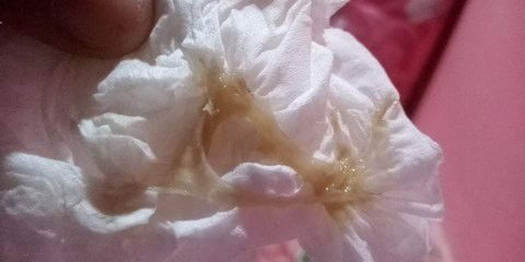 แม่ๆคนไหนเป็นบ้างค่ะ