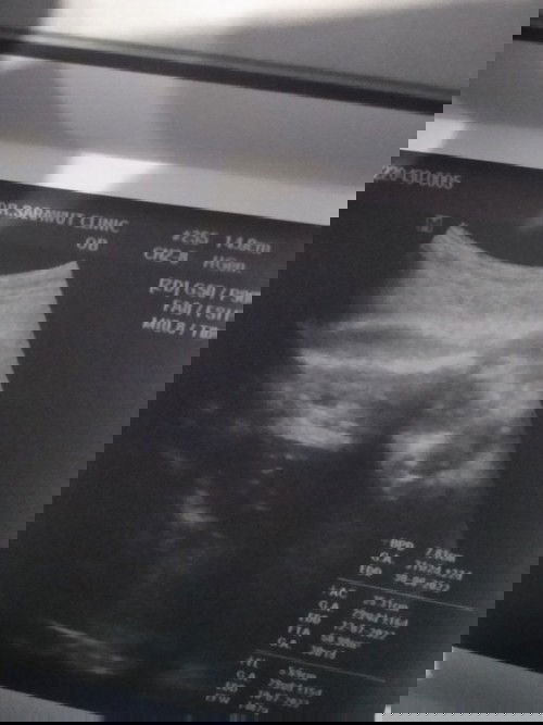 ดูออกไหมคะ😅