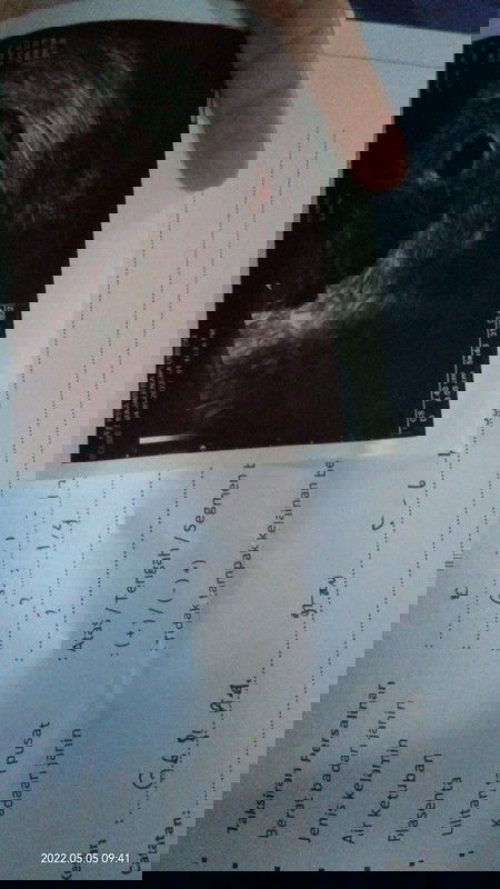 Hasil USG setelah flek di kehamilan TM 1