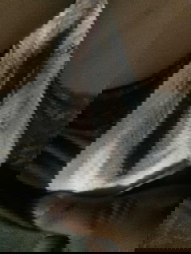 Bleeding, heavy bleeding