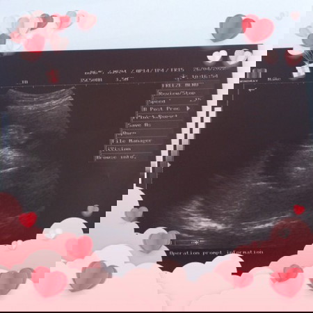 ให้แม่ๆเดานะคะ ว่าน้องเพศอะไร