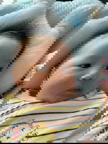 น้องมีผดตามใบหน้า เป็นเพิ่มขค้นทุกวันแดงตกสะเก็ดบ้าง ทำไงดีคะจะหายเองไหม อายุ1เดือน6วันค่ะ