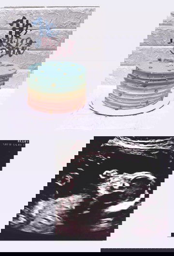 Gender Reveal tomorrow!