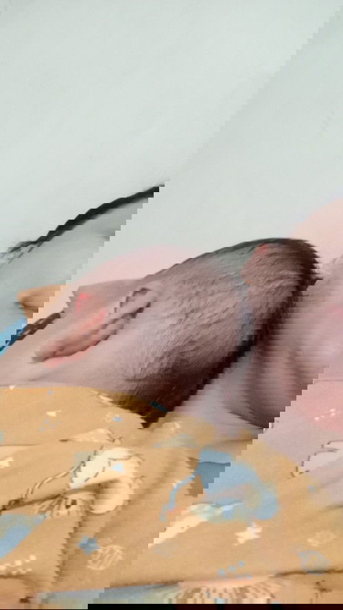 Moms anaku kepala.y agak peyang sdikit,skarang baru usia 8 bln msh bisa diperbaiki/tdk?