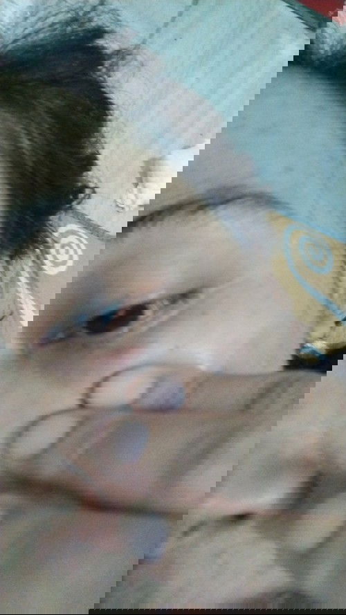 Ketularan dr ponakan,entah apa ini