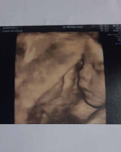 ซาวด์แบบ4มิติ