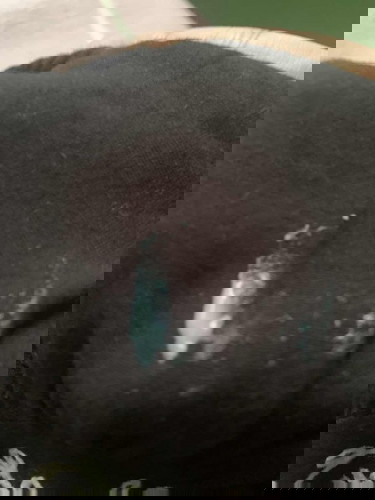 White vaginarl discharge