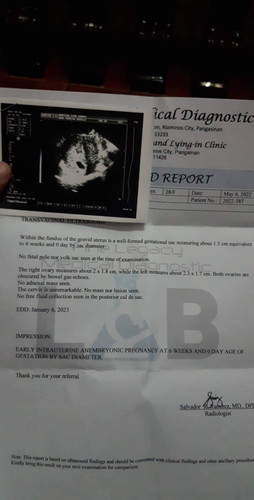 May same case po ba?