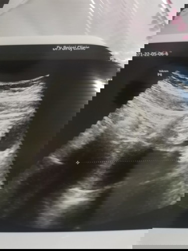 ลูกหลุดตอน4สัปดาห์