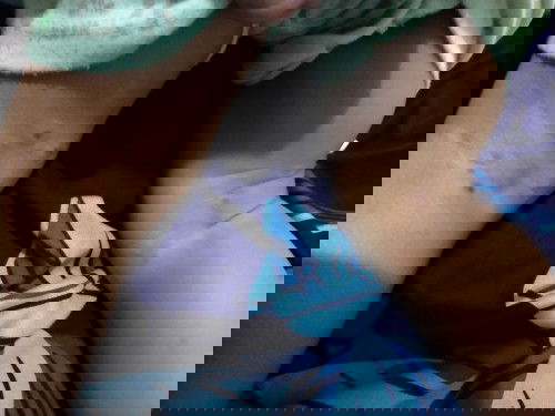 Badan tiba" bentol" dan semakin banyak