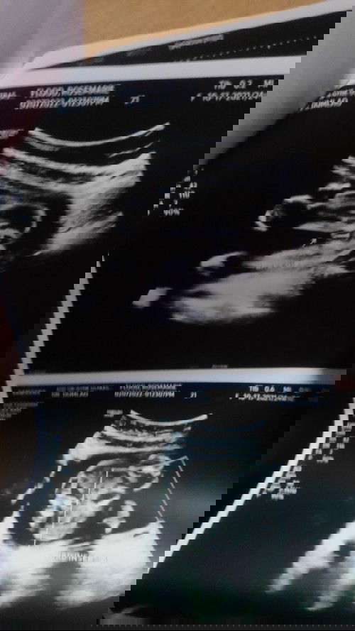 it's A baby Girl ❤️