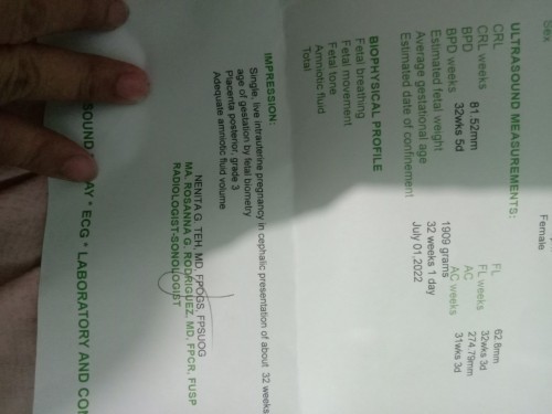Ok lng po yung result ko