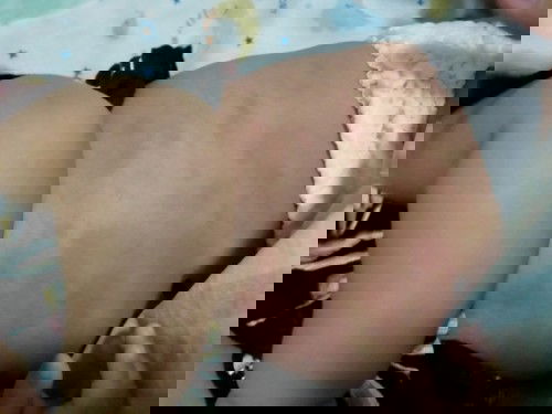 ลูกมีผื่นแดงขึ้น