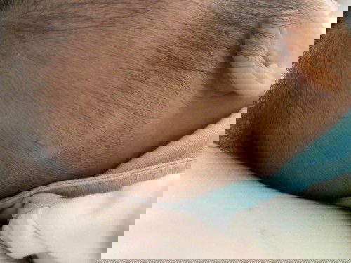 ผมลูกไม่ขึ้น ทำไงดี