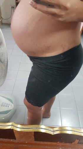 ทีมกรกฏา ท้องแตกจนได้