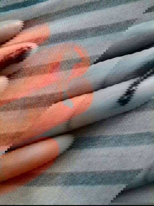 ทำไมมีก้อนเลือดเหนียวๆออกมาจากช่องคลอดคะ