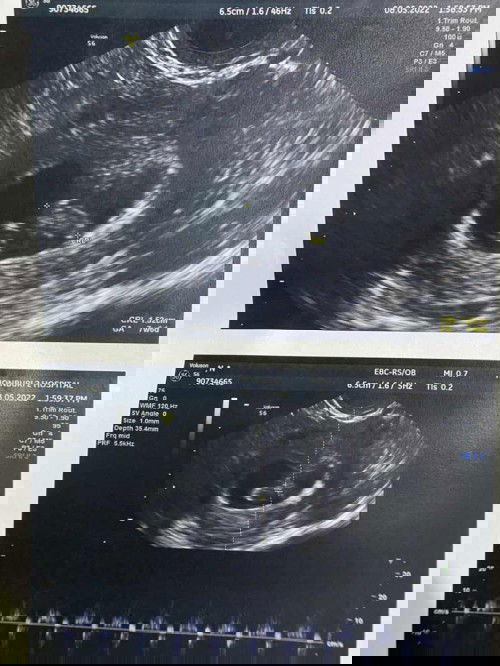 เห็นน้องแล้ว 7วีค 6 วัน