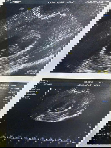 เห็นน้องแล้ว 7วีค 6 วัน