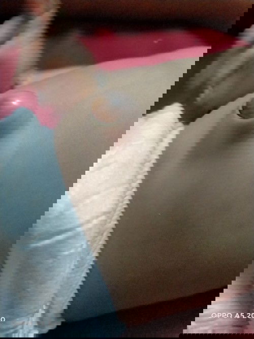 สะดือลูกตั้งแต่หลุดก็เป็นแบบในรูปค่ะจะเป็นอันตรายไหมค่ะเวลาบิดหรือเบ่งจะบวมขึ้นจนตึงค่ะ