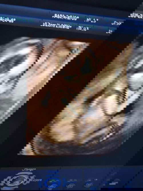 อยากรู้ว่า.  กี่เดือนลูกถึงจะถีบท้องเรา