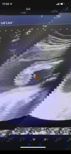 สอบถามเพศลูก