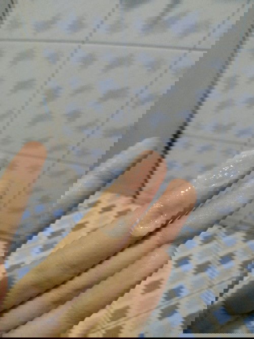 นั่งอึอยู่แล้ว มีอันนี้คาที่น้องสาวอยู่ คืออะไรเหรอคะ พึ่งจะ22W6Dเอง