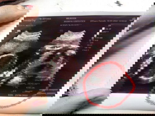 HPL Hari Perkiraan Lahir