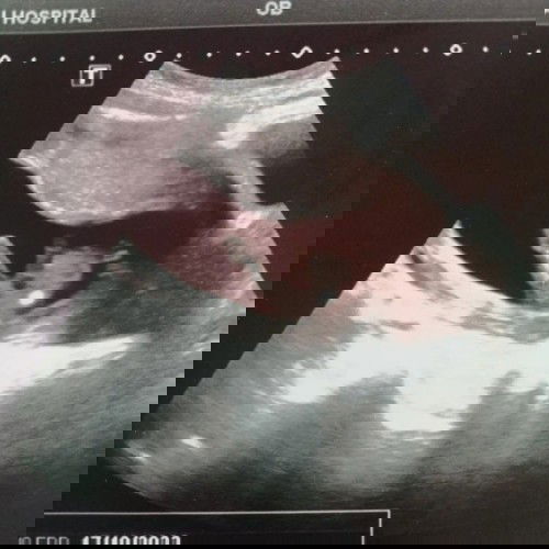 ลุ้นเพศลูก