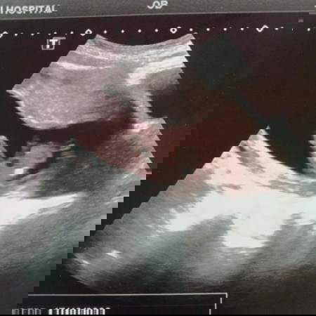 ลุ้นเพศลูก