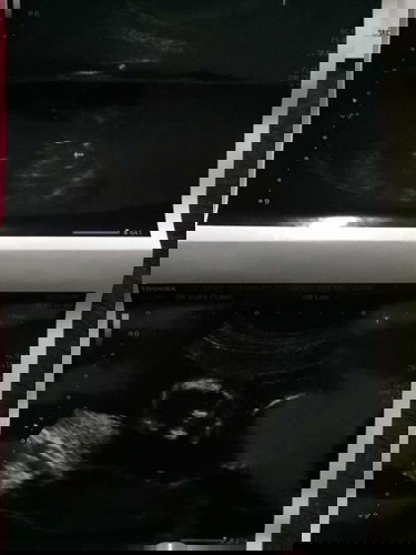 รบกวนแม่ๆช่วยตอบหน่อยนะคะ อยากได้ลูกสาวคะ🤣