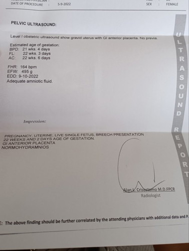 21 weeks and 6 days-di pa kita gender ni baby, normal po b result? sarado pla OB kasi eleksyon