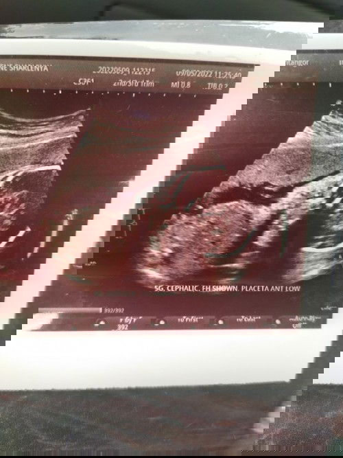 ada yang pandai baca gambar ni tak? ni kepala dan badan kan?😅